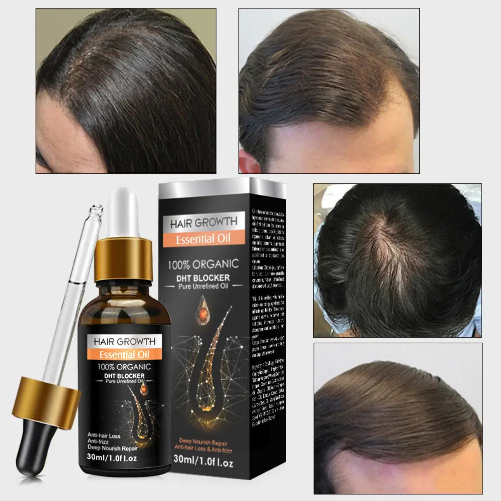 Ginger Hair Growth Essential Oil 100% Organic Loss Regrowth Treatment Strengthens Hair Nourishes Scalp