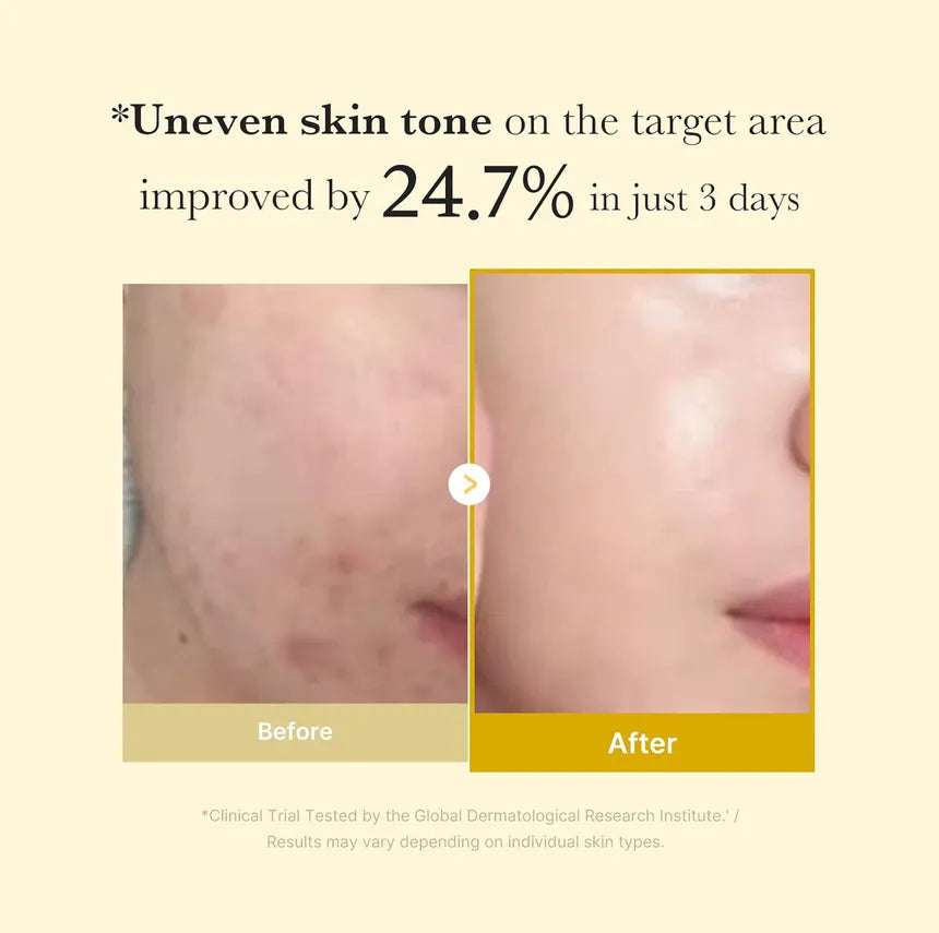 MEDICUBE Kojic Acid Turmeric Overnight Wrapping Peel Off Mask – Glowing Complexion, Korean Skincare