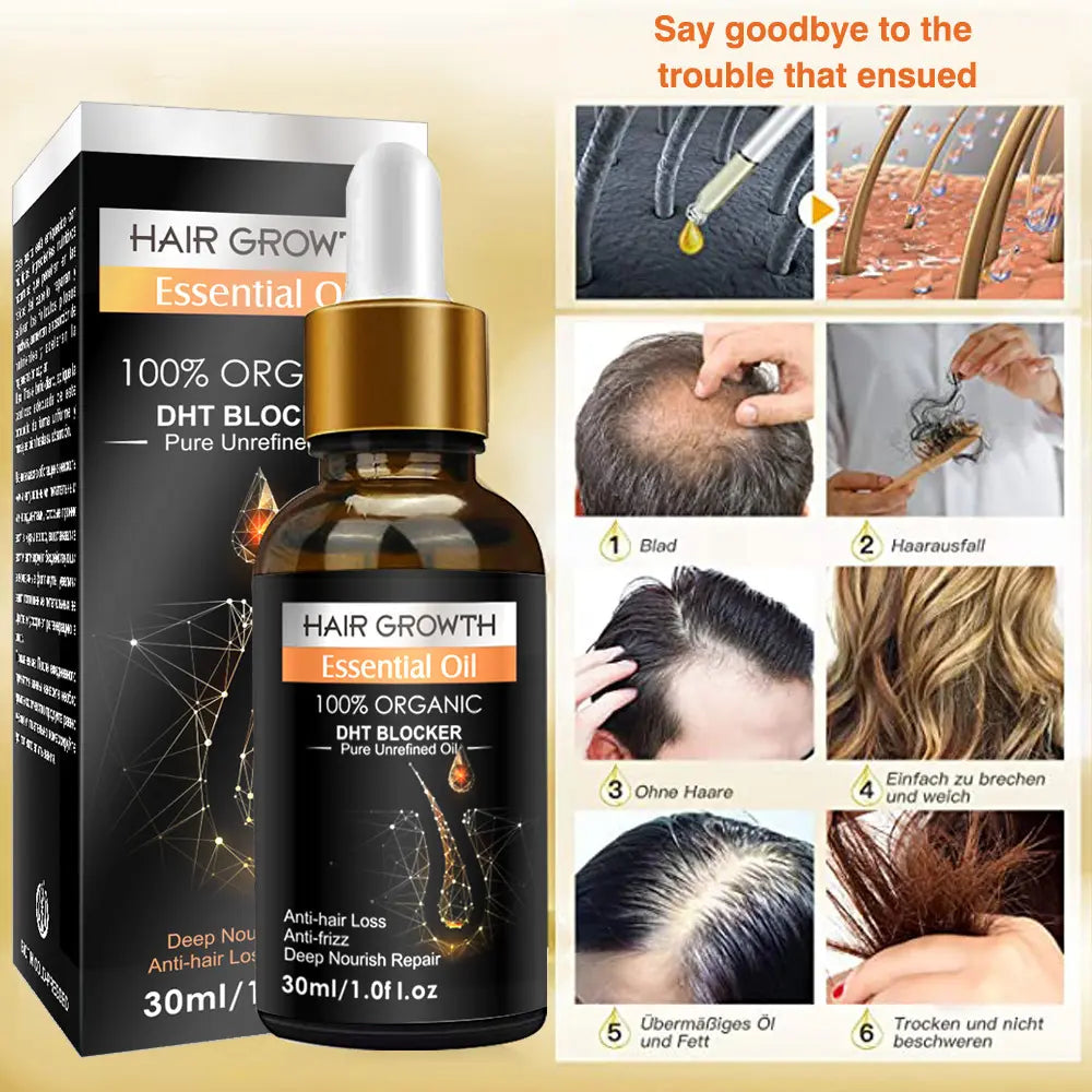 Ginger Hair Growth Essential Oil 100% Organic Loss Regrowth Treatment Strengthens Hair Nourishes Scalp