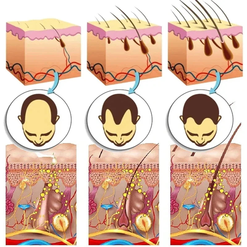 Ginger Hair Growth Essential Oil 100% Organic Loss Regrowth Treatment Strengthens Hair Nourishes Scalp
