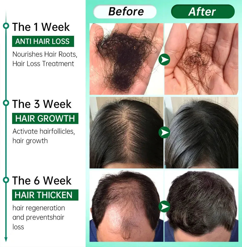 Ginger Hair Growth Essential Oil 100% Organic Loss Regrowth Treatment Strengthens Hair Nourishes Scalp
