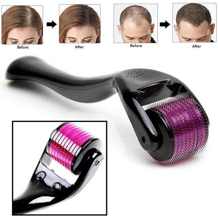 Hair Growth Essential Oil Regrowth Treatment + Derma Roller 0.5 mm 540 Titanium Needles